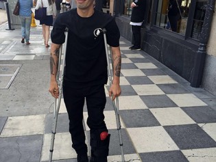 Milton_on_crutches